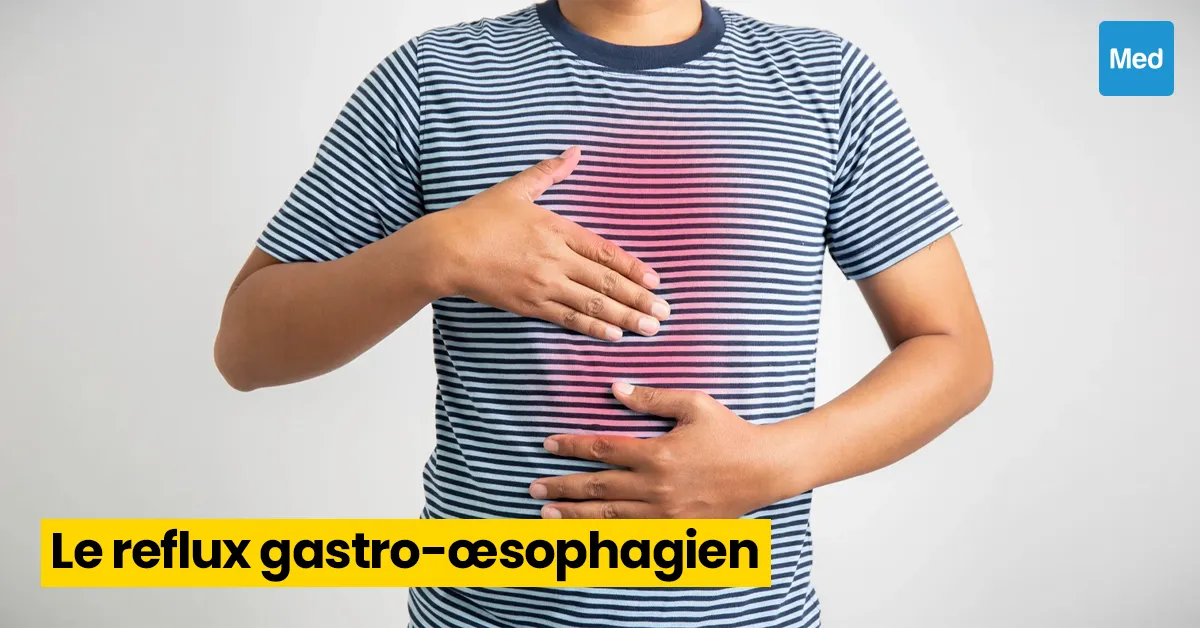 Reflux gastro-œsophagien (RGO) : causes, symptômes et traitement